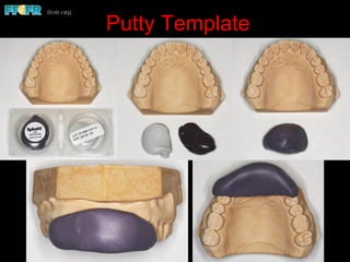 Putty Template
 