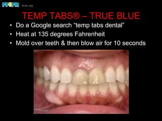 TEMP TABS® – TRUE BLUE
•  Do a Google search “temp tabs dental”
•  Heat at 135 degrees Fahrenheit
•  Mold over teeth & then blow air for 10 seconds
 