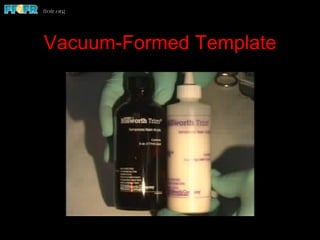 Vacuum-Formed Template
 