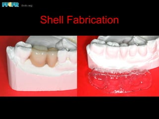 Shell Fabrication
 