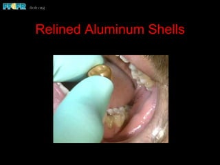 Relined Aluminum Shells
 