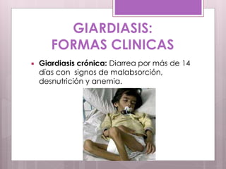  Giardiasis crónica: Diarrea por más de 14
días con signos de malabsorción,
desnutrición y anemia.
GIARDIASIS:
FORMAS CLINICAS
 