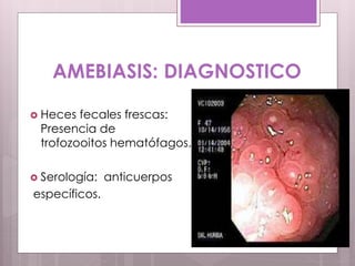 AMEBIASIS: DIAGNOSTICO
 Heces fecales frescas:
Presencia de
trofozooitos hematófagos.
 Serología: anticuerpos
específicos.
 