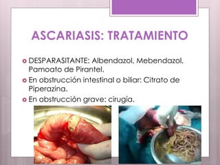 ASCARIASIS: TRATAMIENTO
 DESPARASITANTE: Albendazol, Mebendazol,
Pamoato de Pirantel.
 En obstrucción intestinal o biliar: Citrato de
Piperazina.
 En obstrucción grave: cirugía.
 