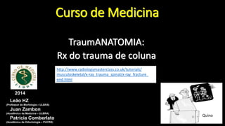 Curso de Medicina
TraumANATOMIA:
Rx do trauma de coluna
2014
Leão HZ
(Professor de Morfologia – ULBRA)
Juan Zambon
(Acadêmico de Medicina – ULBRA)
Patrícia Comberlato
(Acadêmica de Odontologia – PUCRS)
Quino
http://www.radiologymasterclass.co.uk/tutorials/
musculoskeletal/x-ray_trauma_spinal/x-ray_fracture_
end.html
 