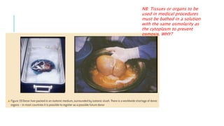 NB: Tissues or organs to be
used in medical procedures
must be bathed in a solution
with the same osmolarity as
the cytoplasm to prevent
osmosis. WHY?
 
