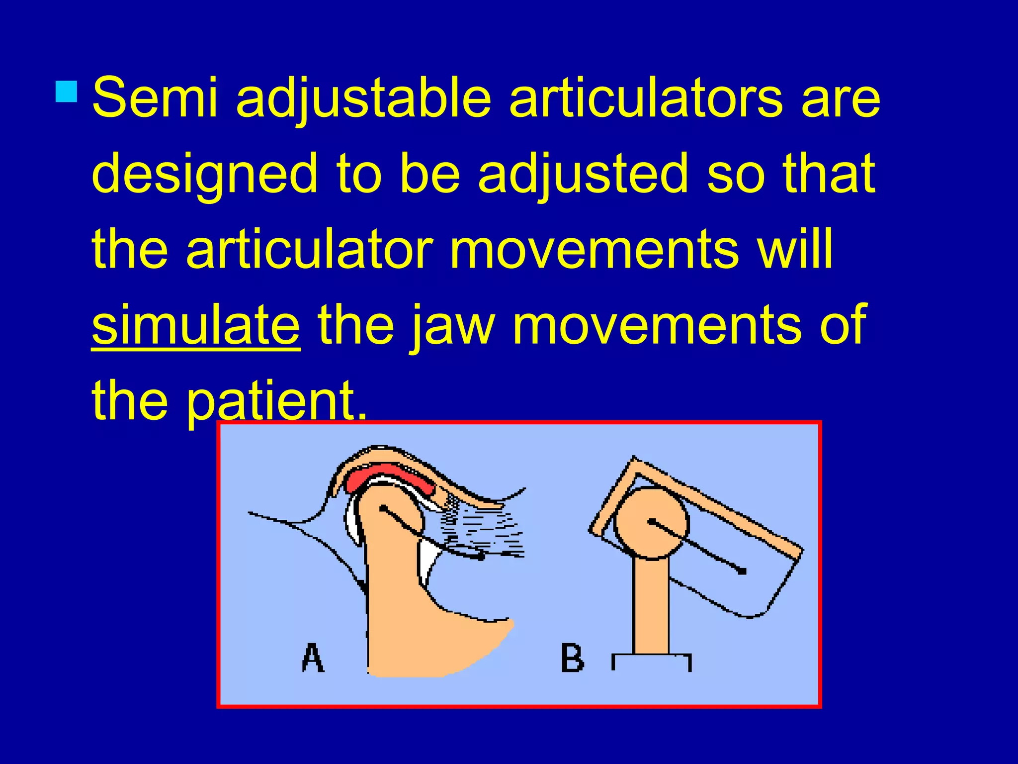  Semi adjustable articulators are
designed to be adjusted so that
the articulator movements will
simulate the jaw movements of
the patient.
 