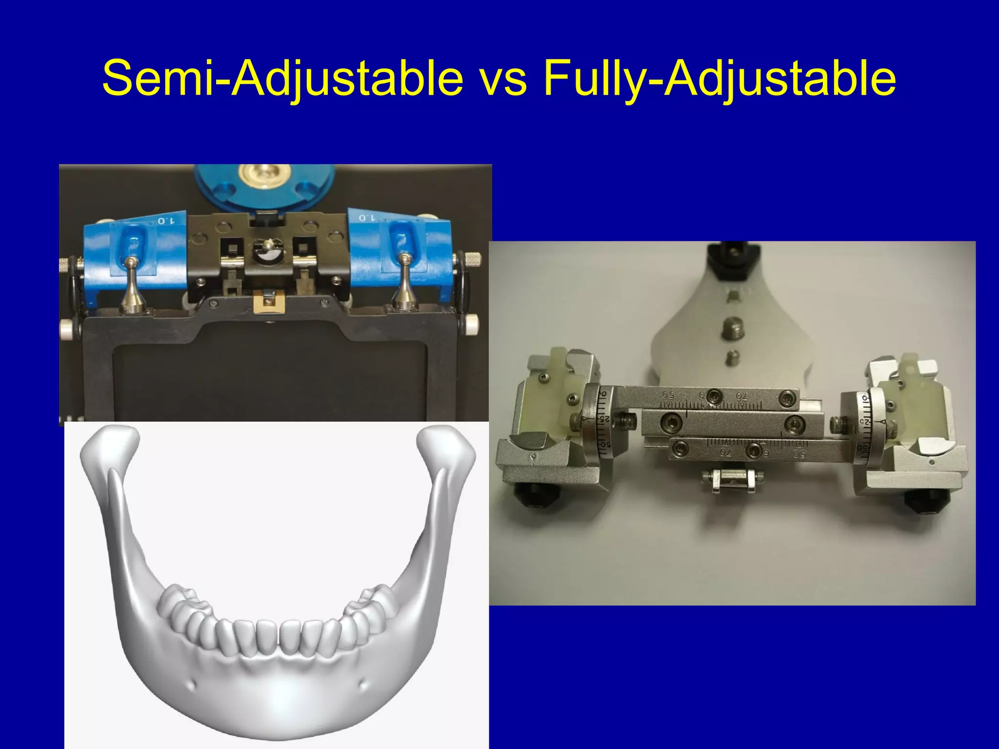 Semi-Adjustable vs Fully-Adjustable
 