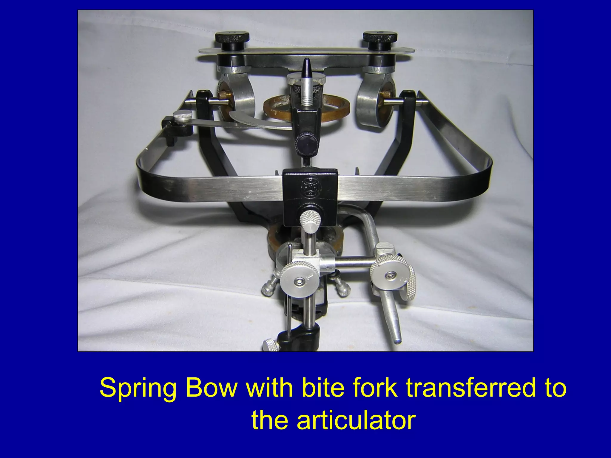 Spring Bow with bite fork transferred to
the articulator
 