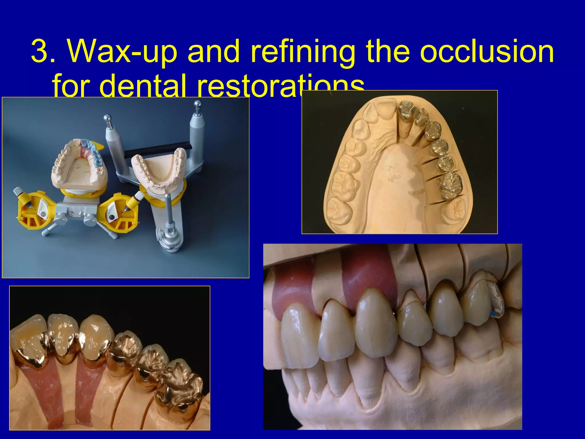 3. Wax-up and refining the occlusion
for dental restorations.
 