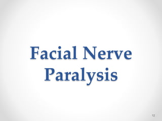 Facial Nerve
Paralysis
12
 