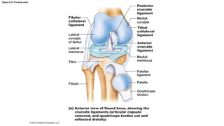 Figure 8.7e The knee joint.
Posterior
cruciate
ligament
Fibular
collateral
ligament
Medial
condyle
Tibial
collateral
ligament
Anterior
cruciate
ligament
Medial
meniscus
Patellar
ligament
Patella
Quadriceps
tendon
Lateral
condyle
of femur
Lateral
meniscus
Tibia
Fibula
Anterior view of flexed knee, showing the
cruciate ligaments (articular capsule
removed, and quadriceps tendon cut and
reflected distally)
© 2016 Pearson Education, Inc.
 