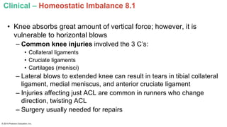 Clinical – Homeostatic Imbalance 8.1
• Knee absorbs great amount of vertical force; however, it is
vulnerable to horizontal blows
– Common knee injuries involved the 3 C’s:
• Collateral ligaments
• Cruciate ligaments
• Cartilages (menisci)
– Lateral blows to extended knee can result in tears in tibial collateral
ligament, medial meniscus, and anterior cruciate ligament
– Injuries affecting just ACL are common in runners who change
direction, twisting ACL
– Surgery usually needed for repairs
© 2016 Pearson Education, Inc.
 