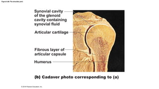 Figure 8.9b The shoulder joint.
Synovial cavity
of the glenoid
cavity containing
synovial fluid
Articular cartilage
Fibrous layer of
articular capsule
Humerus
Cadaver photo corresponding to (a)
© 2016 Pearson Education, Inc.
 