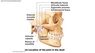 Figure 8.12a The temporomandibular (jaw) joint.
Mandibular fossa
Articular tubercle
Zygomatic process
Infratemporal fossa
External
acoustic
meatus
Articular
capsule
Ramus of
mandible
Lateral
ligament
Location of the joint in the skull
© 2016 Pearson Education, Inc.
 