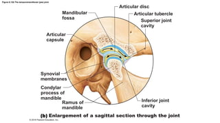 Figure 8.12b The temporomandibular (jaw) joint.
Articular disc
Mandibular
fossa
Articular tubercle
Superior joint
cavity
Articular
capsule
Synovial
membranes
Condylar
process of
mandible
Ramus of
mandible
Inferior joint
cavity
Enlargement of a sagittal section through the joint
© 2016 Pearson Education, Inc.
 