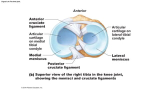 Figure 8.7b The knee joint.
Anterior
Anterior
cruciate
ligament
Articular
cartilage
on medial
tibial
condyle
Medial
meniscus
Posterior
cruciate ligament
Superior view of the right tibia in the knee joint,
showing the menisci and cruciate ligaments
Articular
cartilage on
lateral tibial
condyle
Lateral
meniscus
© 2016 Pearson Education, Inc.
 