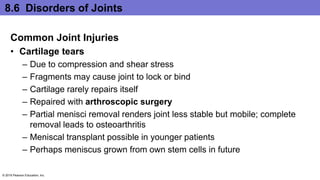 8.6 Disorders of Joints
Common Joint Injuries
• Cartilage tears
– Due to compression and shear stress
– Fragments may cause joint to lock or bind
– Cartilage rarely repairs itself
– Repaired with arthroscopic surgery
– Partial menisci removal renders joint less stable but mobile; complete
removal leads to osteoarthritis
– Meniscal transplant possible in younger patients
– Perhaps meniscus grown from own stem cells in future
© 2016 Pearson Education, Inc.
 