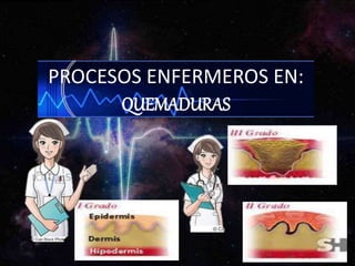 PROCESOS ENFERMEROS EN:
QUEMADURAS
 