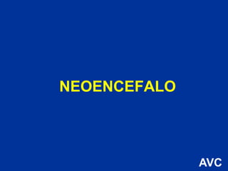 NEOENCEFALO
AVC
 