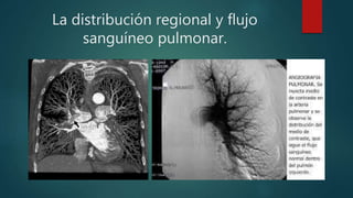 La distribución regional y flujo
sanguíneo pulmonar.
 