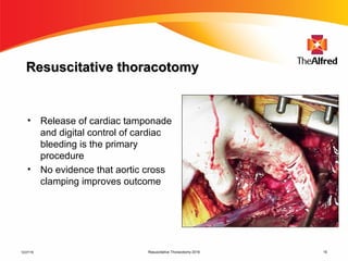 Resuscitative Thoracotomy 2016 15
Resuscitative thoracotomyResuscitative thoracotomy
• Release of cardiac tamponade
and digital control of cardiac
bleeding is the primary
procedure
• No evidence that aortic cross
clamping improves outcome
12/27/16
 