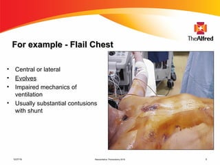 Resuscitative Thoracotomy 2016 5
For example - Flail ChestFor example - Flail Chest
• Central or lateral
• Evolves
• Impaired mechanics of
ventilation
• Usually substantial contusions
with shunt
12/27/16
 