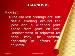 DIAGNOSIS
X-ray:
The earliest findings are soft
tissue swelling around the
joint and a widened joint
space from joint effusion.
Displacement of adjacent fat
pads may be present,
especially in infants and
children.
30-Dec-14 16Pawan KB Agrawal
 