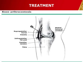 TREATMENT
30-Dec-14 Pawan KB Agrawal 28
 