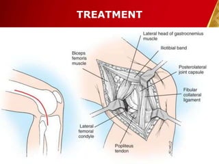 TREATMENT
30-Dec-14 Pawan KB Agrawal 29
 