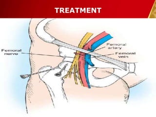 TREATMENT
30-Dec-14 Pawan KB Agrawal 31
 