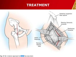 TREATMENT
30-Dec-14 Pawan KB Agrawal 32
 