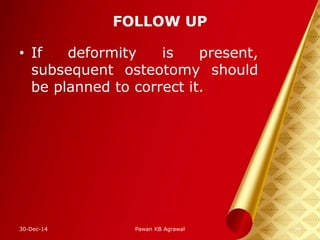 FOLLOW UP
• If deformity is present,
subsequent osteotomy should
be planned to correct it.
30-Dec-14 Pawan KB Agrawal 34
 
