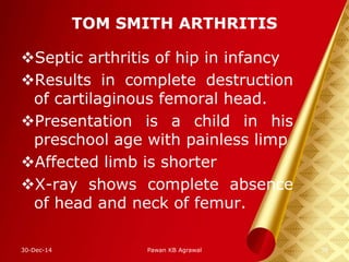 TOM SMITH ARTHRITIS
Septic arthritis of hip in infancy
Results in complete destruction
of cartilaginous femoral head.
Presentation is a child in his
preschool age with painless limp
Affected limb is shorter
X-ray shows complete absence
of head and neck of femur.
30-Dec-14 38Pawan KB Agrawal
 