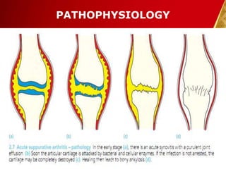 PATHOPHYSIOLOGY
30-Dec-14 9Pawan KB Agrawal
 