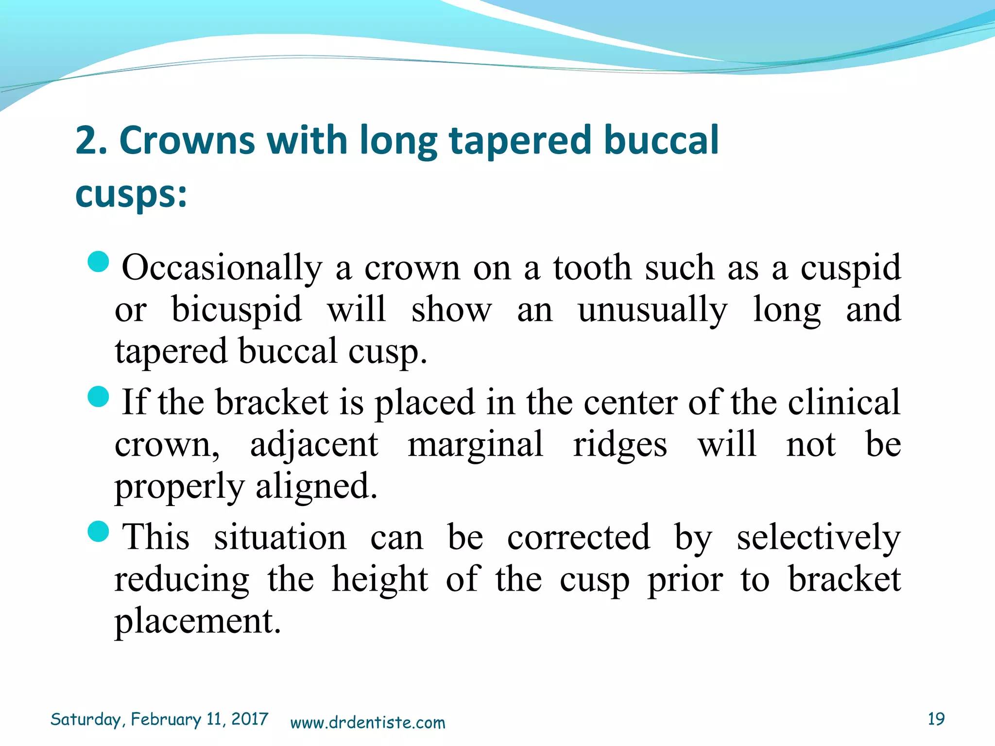 2. Crowns with long tapered buccal
cusps:
Occasionally a crown on a tooth such as a cuspid
or bicuspid will show an unusually long and
tapered buccal cusp.
If the bracket is placed in the center of the clinical
crown, adjacent marginal ridges will not be
properly aligned.
This situation can be corrected by selectively
reducing the height of the cusp prior to bracket
placement.
Saturday, February 11, 2017 19www.drdentiste.com
 