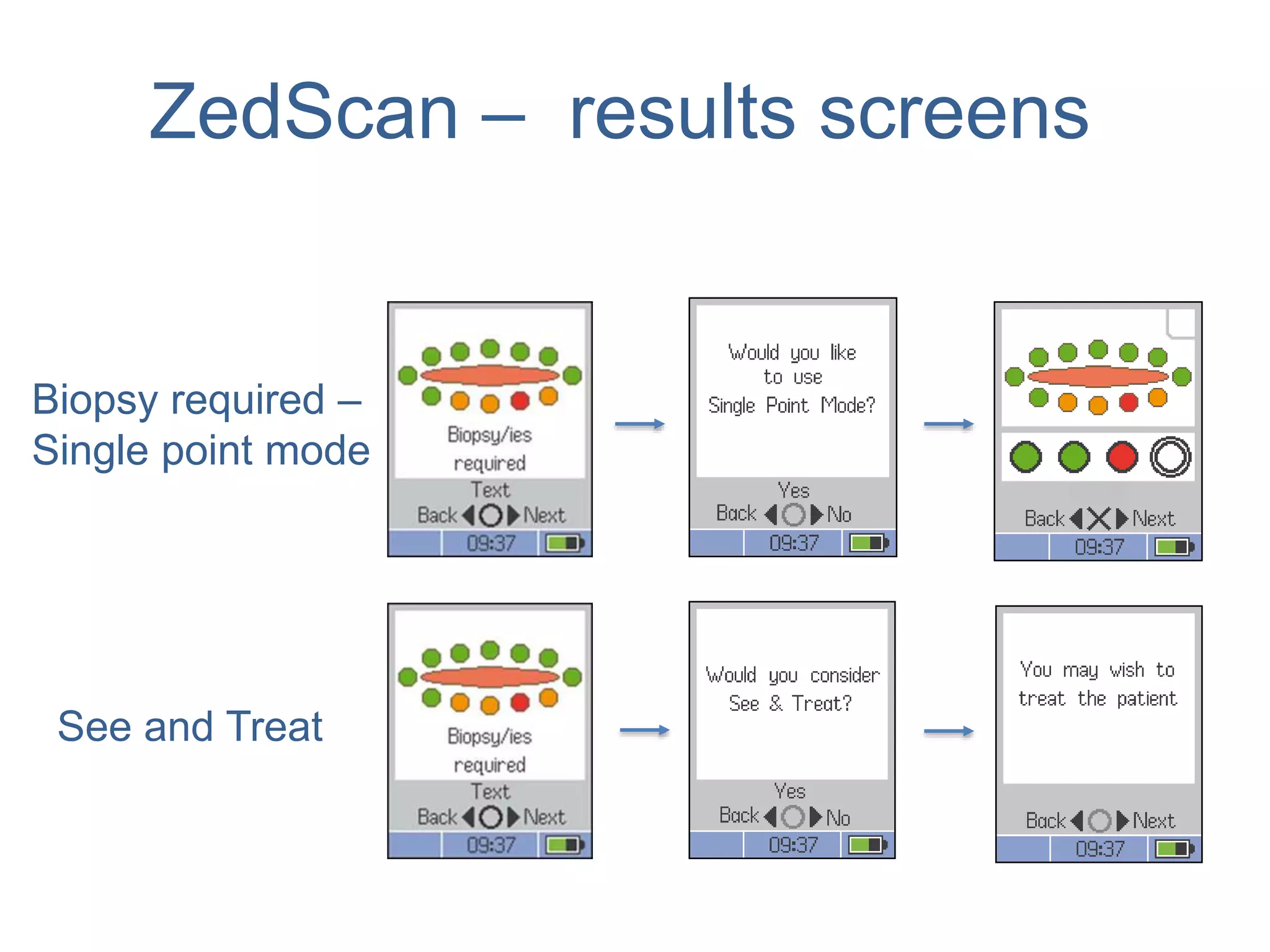 ZedScan – results screens
See and Treat
Biopsy required –
Single point mode
 