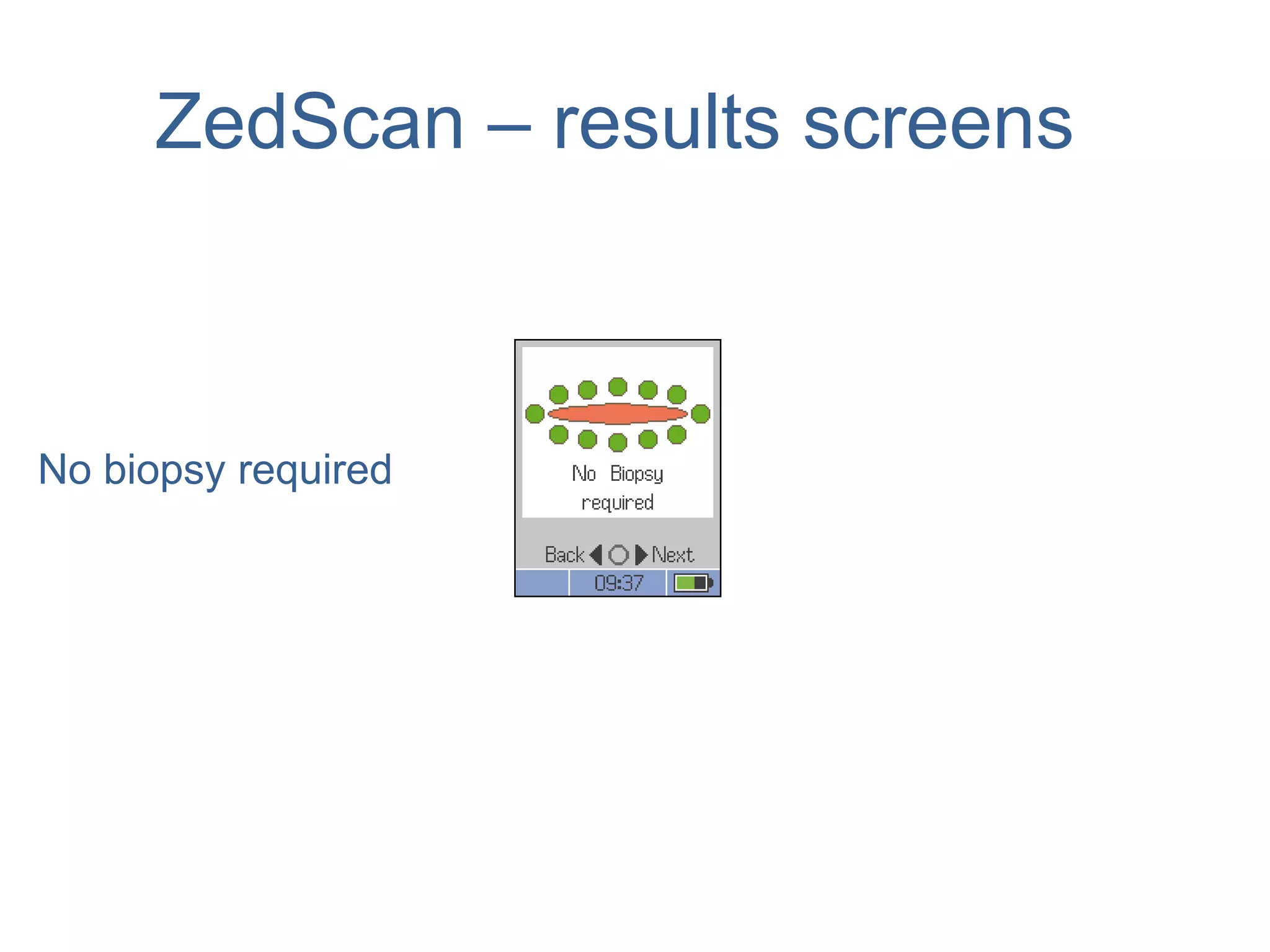 ZedScan – results screens
No biopsy required
 