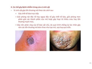 15
4. Cơ chế gây bệnh nhiễm trùng của vi sinh vật
‒ Vi sinh vật gây tổn thương mô theo các cách sau:
+ Gây chết tế bào trực tiếp
+ Giải phóng nội độc tố hay ngoại độc tố gây chết tế bào, giải phóng men
phân giải các thành phần của mô hoặc gây hoại tử thiêu máu hay tổn
thương mạch máu.
+ Gây nên phản ứng của tế bào vật chủ, do quá trình chống lại tác nhân gây
nên các tổn thương mô kèm thao như tạo mủ, sẹo hay quá mẫn.
 