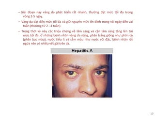 10
‒ Giai đoạn này vàng da phát triển rất nhanh, thường đạt mức tối đa trong
vòng 2-5 ngày.
‒ Vàng da đạt đến mức tối đa và giữ nguyên mức ổn định trong vài ngày đến vài
tuần (thường từ 2 - 4 tuần).
‒ Trong thời kỳ này các triệu chứng về lâm sàng và cận lâm sàng tăng lên tới
mức tối đa. ở những bệnh nhân vàng da nặng, phân trắng giống như phân cò
(phân bạc màu), nước tiểu ít và sẫm màu như nước vối đặc, bệnh nhân rất
ngứa nên có nhiều vết gãi trên da.
 