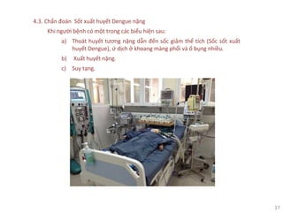 17
4.3. Chẩn đoán Sốt xuất huyết Dengue nặng
Khi người bệnh có một trong các biểu hiện sau:
a) Thoát huyết tương nặng dẫn đến sốc giảm thể tích (Sốc sốt xuất
huyết Dengue), ứ dịch ở khoang màng phổi và ổ bụng nhiều.
b) Xuất huyết nặng.
c) Suy tạng.
 