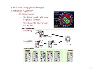 20
B. Chẩn đoán căn nguyên vi rút Dengue
a. Xét nghiệm huyết thanh
‒ Xét nghiệm nhanh:
+ Tìm kháng nguyên NS1 trong
5 ngày đầu của bệnh.
+ Tìm kháng thể IgM từ ngày
thứ 5 trở đi.
 