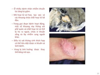 13
‒ Ở nhiều bệnh nhân nhiễm khuẩn
lúc tăng lúc giảm.
‒ Mô hoại tử xơ hoá, tạo sẹo và
các khoang chứa chất hoại tử bã
đậu.
‒ Trong giai đoạn bệnh hoạt động,
một số khoang này thông với
phế quản và chất hoại tử có thể
bị ho ra ngoài, chứa vi khuẩn
sống và lây nhiễm sang người
khác.
‒ Điều trị với kháng sinh thích hợp
có thể tiêu diệt được vi khuẩn và
lành bệnh.
‒ Vùng bị ảnh hưởng được thay
thế bằng mô sẹo.
 
