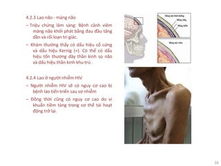 16
4.2.3 Lao não - màng não
‒ Triệu chứng lâm sàng: Bệnh cảnh viêm
màng não khởi phát bằng đau đầu tăng
dần và rối loạn tri giác.
‒ Khám thường thấy có dấu hiệu cổ cứng
và dấu hiệu Kernig (+). Có thể có dấu
hiệu tổn thương dây thần kinh sọ não
và dấu hiệu thần kinh khu trú .
4.2.4 Lao ở người nhiễm HIV
‒ Người nhiễm HIV sẽ có nguy cơ cao bị
bệnh lao tiến triển sau sơ nhiễm
‒ Đồng thời cũng có nguy cơ cao do vi
khuẩn tiềm tàng trong cơ thể tái hoạt
động trở lại.
 