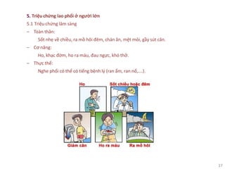 17
5. Triệu chứng lao phổi ở người lớn
5.1 Triệu chứng lâm sàng
‒ Toàn thân:
Sốt nhẹ về chiều, ra mồ hôi đêm, chán ăn, mệt mỏi, gầy sút cân.
‒ Cơ năng:
Ho, khạc đờm, ho ra máu, đau ngực, khó thở.
‒ Thực thể:
Nghe phổi có thể có tiếng bệnh lý (ran ẩm, ran nổ,....).
 