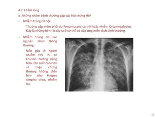 12
4.2.1 Lâm sàng
a. Những nhóm bệnh thường gặp của hội chứng HIV
‒ Nhiễm trùng cơ hội:
Thường gặp viêm phổi do Pneumocytis carinii hoặc nhiễm Cytomegalovius.
Đây là những bệnh ít xảy ra ở cơ thể có đáp ứng miễn dịch bình thường.
‒ Nhiễm trùng do các
nguyên nhân thông
thường:
Nếu gặp ở người
nhiễm HIV thì có
khuynh hướng nặng
hơn, tần suất cao hơn
và triệu chứng
thường không điển
hình như Herpes
simplex virus, nhiễm
lao.
 