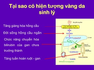 Tại sao có hiện tượng vàng da
sinh lý
Tăng giáng hóa hồng cầu
Đời sống hồng cầu ngắn
Chức năng chuyển hóa
bilirubin của gan chưa
trưởng thành
Tăng tuần hoàn ruột - gan
 
