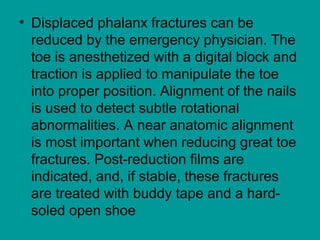 • Displaced phalanx fractures can be
reduced by the emergency physician. The
toe is anesthetized with a digital block and
traction is applied to manipulate the toe
into proper position. Alignment of the nails
is used to detect subtle rotational
abnormalities. A near anatomic alignment
is most important when reducing great toe
fractures. Post-reduction films are
indicated, and, if stable, these fractures
are treated with buddy tape and a hard-
soled open shoe
 