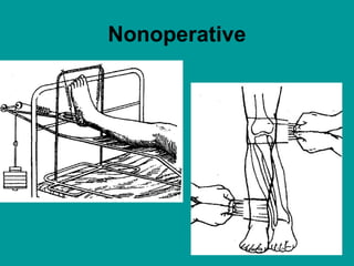 Nonoperative
 