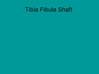 Tibia Fibula Shaft
 